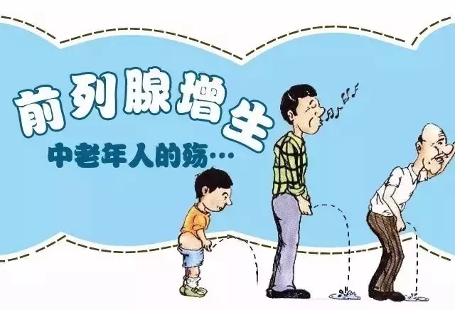 治疗前列腺增生效果好吗？